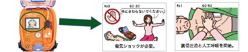 AED-2100カルジオライフ